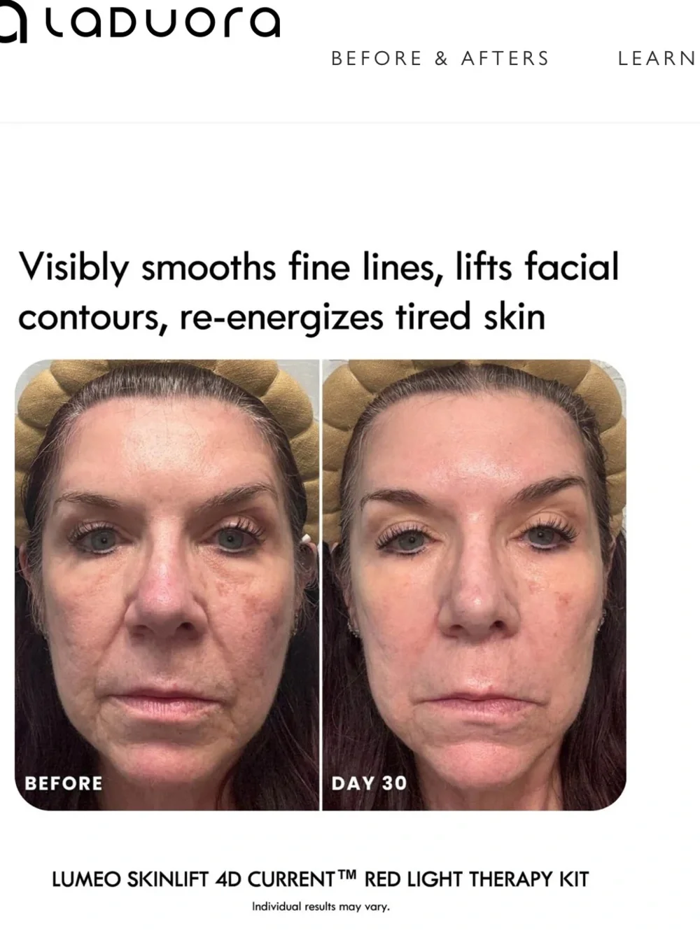 Lumeo SkinLift 4D Current™ Red Light Therapy Kit